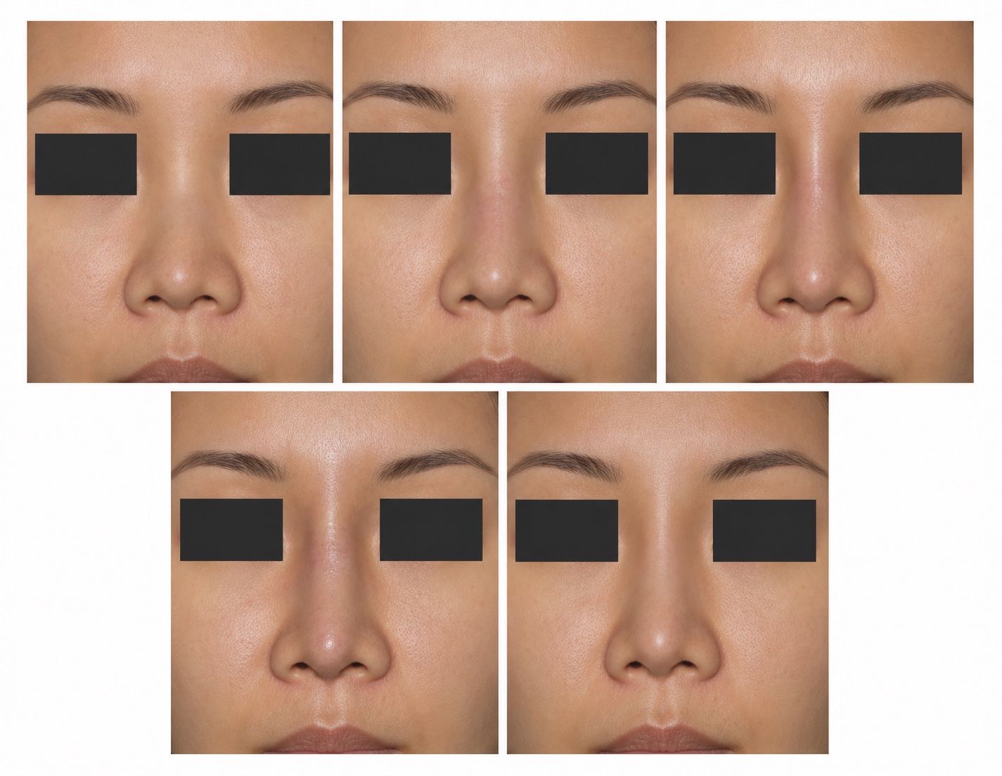 ภาพจำลอง แสดงแนวสันจมูกจากขอบวัสดุและความสูงที่ต่างกัน