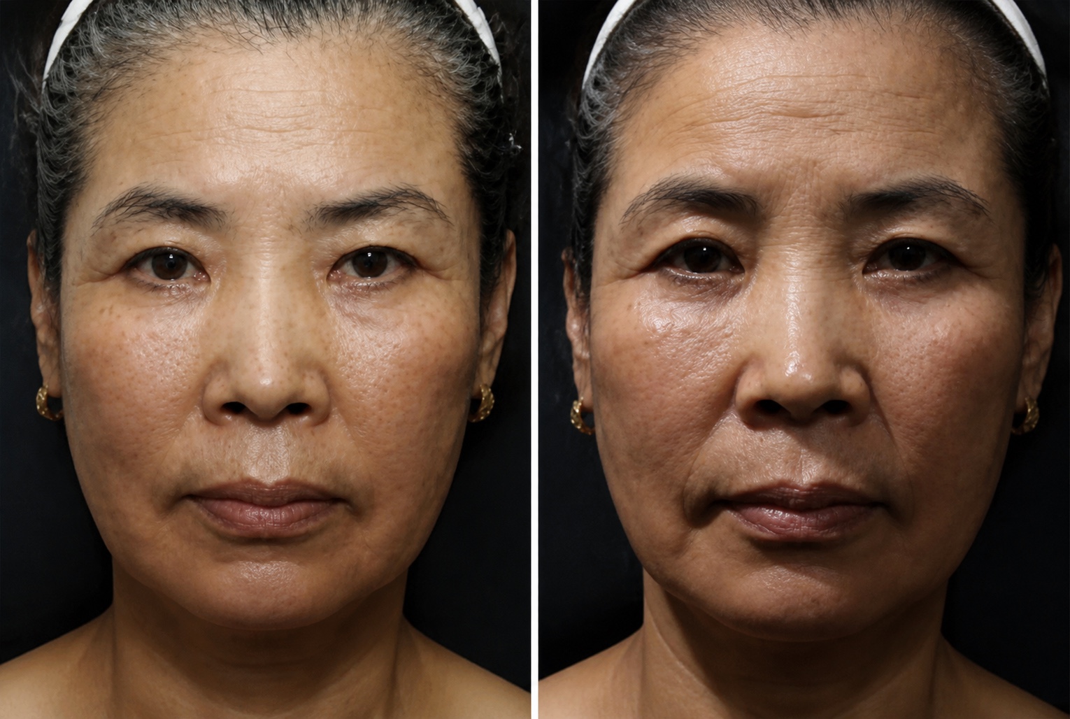 ภาพจำลอง เปรียบเทียบทิศทางแสงตรงและแสงเฉียง